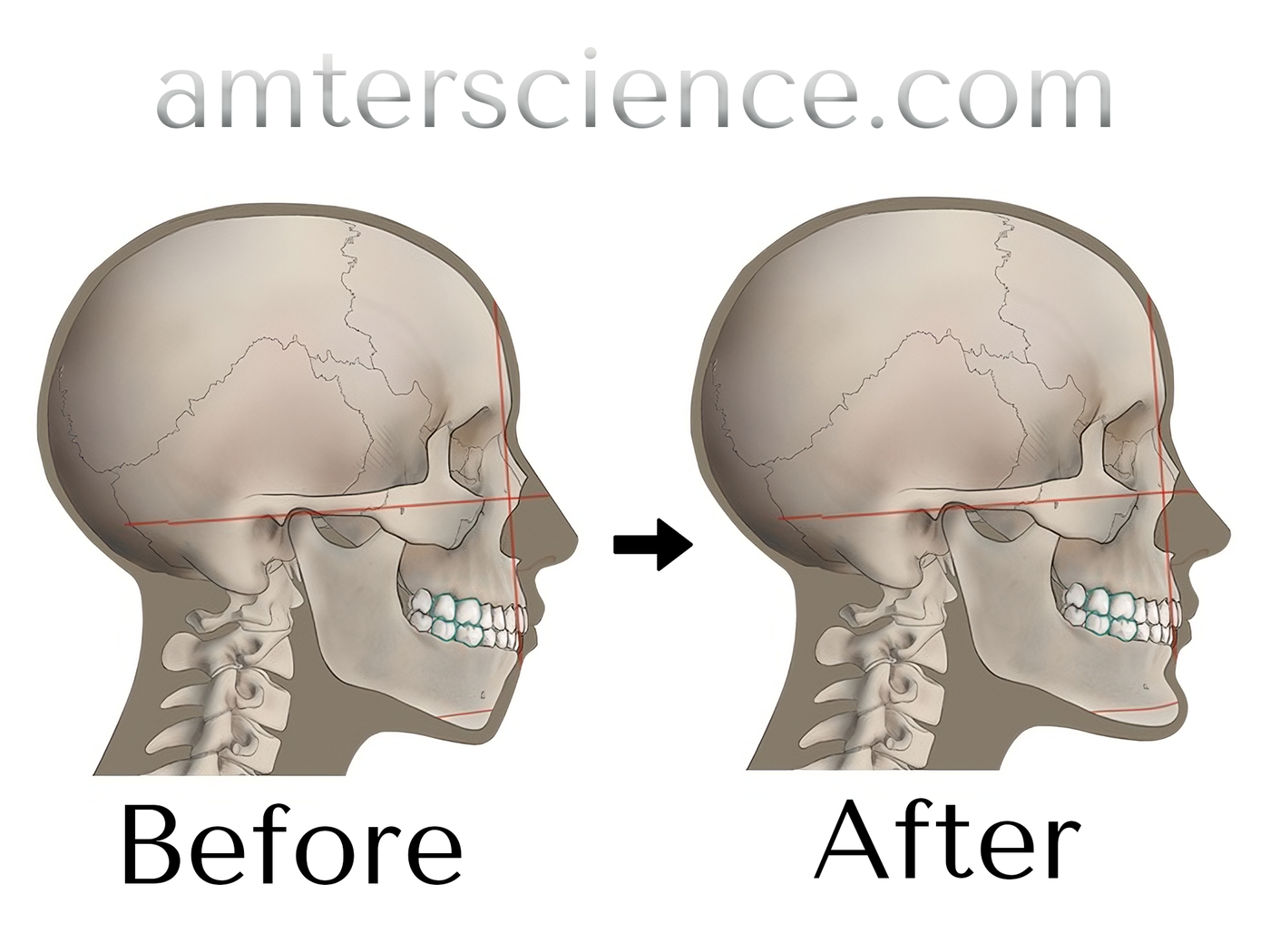 Amter Posture FC1